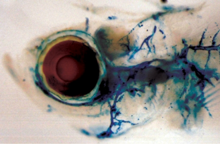 heart-disease-lymphatic-system Lymphatic system of zebrafish.