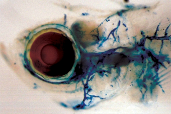 What the Weizmann Institute is Doing About Heart Disease