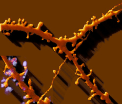neuronal-spine