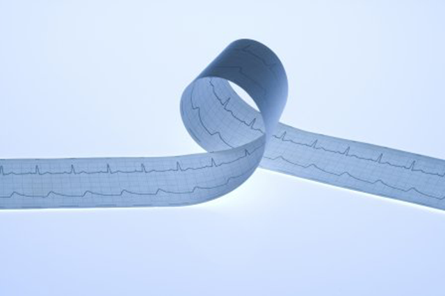 Unraveling Stress Unraveling Stress