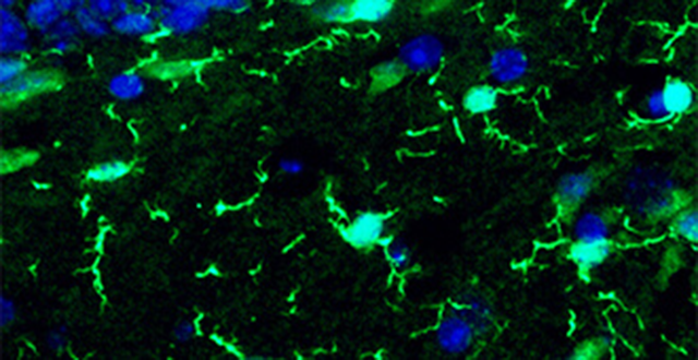 Microglia Microglia