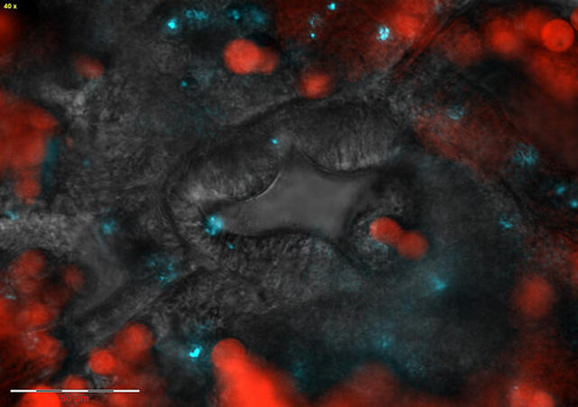 Polyp mouth with symbiotic algae and bacterial pathogens