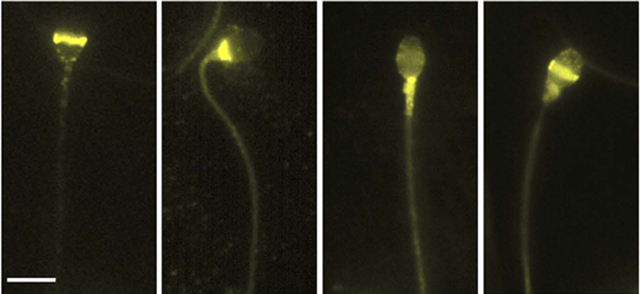 opsins in human sperm opsins in human sperm