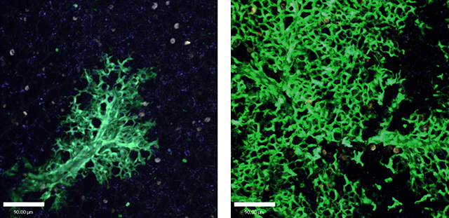 lung cells