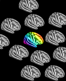 Autistic brains go their own way Autistic brains go their own way