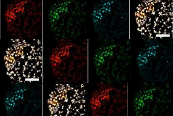 Human Primordial Cells Created in the Lab