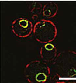 Baker's yeast cells Baker's yeast cells