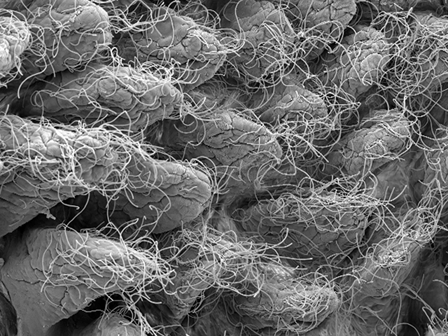 Gut Bacteria Artificial Sweetners Glucose Intolerance Gut Bacteria Artificial Sweetners Glucose Intolerance