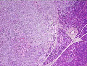 Looking-for-genes-that-drive-cancer-metastatic-melanoma-cells