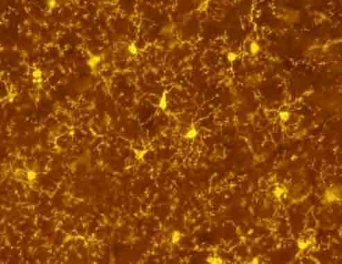 microglia