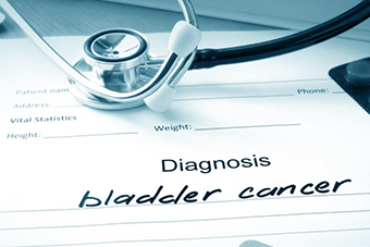 A New Noninvasive Monitoring Test for Bladder Cancer