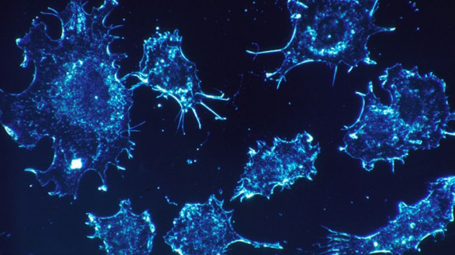 cancer cells cancer cells