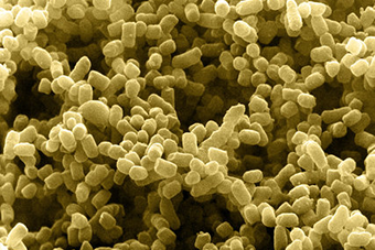40 Trillion Bacteria on and in Us? Fewer Than We Thought.