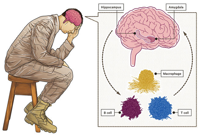 PTSD brain