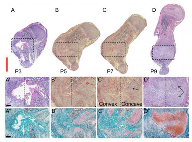 Discovery of How Newborn Mice Repair Bone Fractures