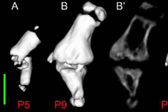 Discovery of How Newborn Mice Repair Bone Fractures Could Improve Treatments