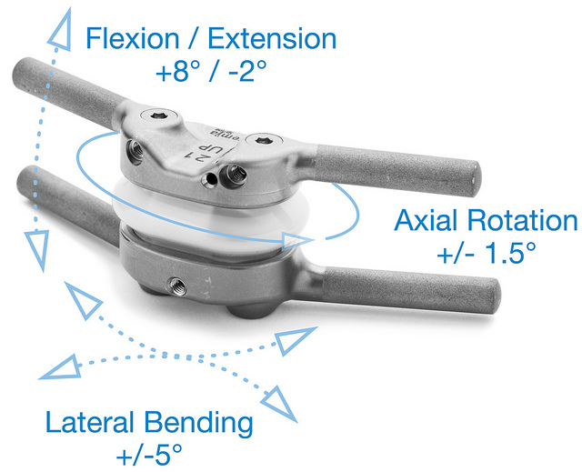 spinal-implant