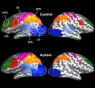 Identifying Autism Early
