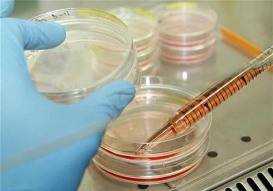 Israelis Make Major Breakthrough in Turning Mature Cells into Skin Cells