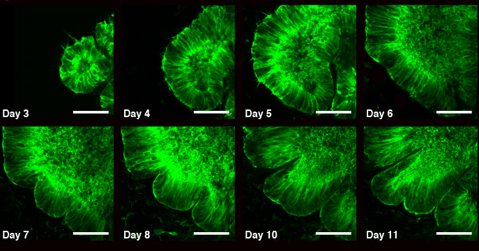 Israeli Scientists Grow ‘Tiny Brains’ to Study How Its Folds Are Created