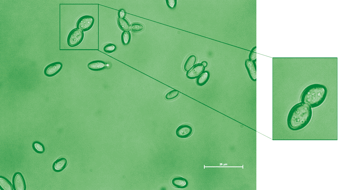 Fungus Vs. Fungus Newly Identified Yeast Might Prevent Life Threatening Fungal Infections 4