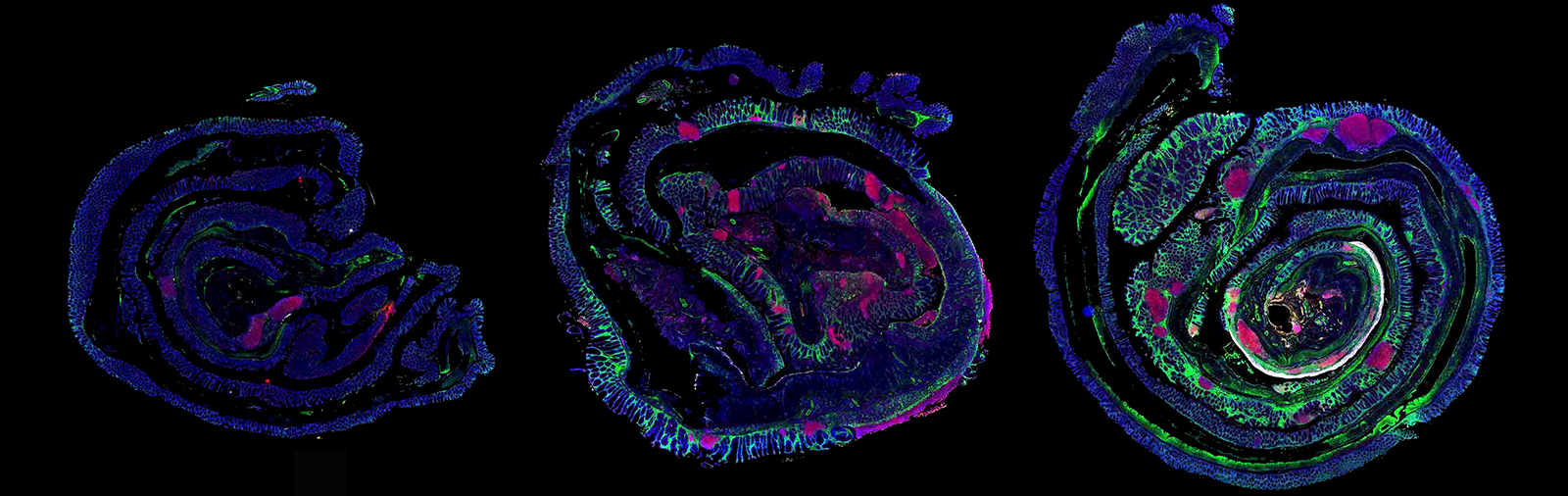 When The Gut Can’T Forget A New Mechanism Promoting Inflammatory Bowel Disease 2