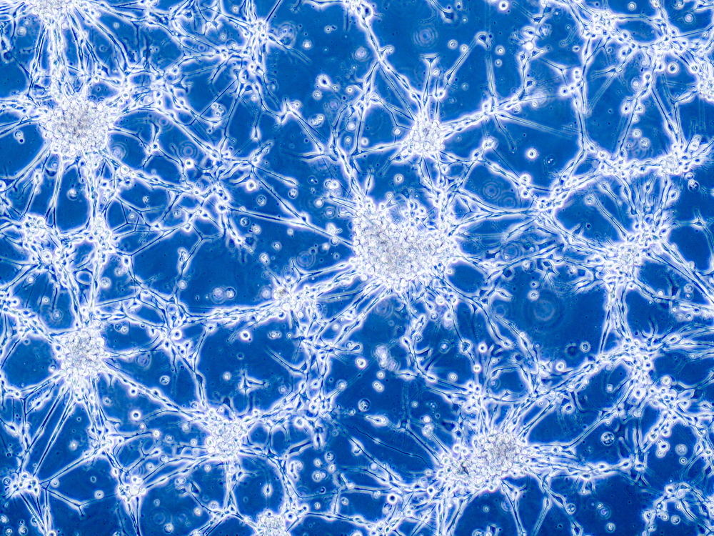 Israeli-U.S. Research Finds Brain Cancer Cells Change State