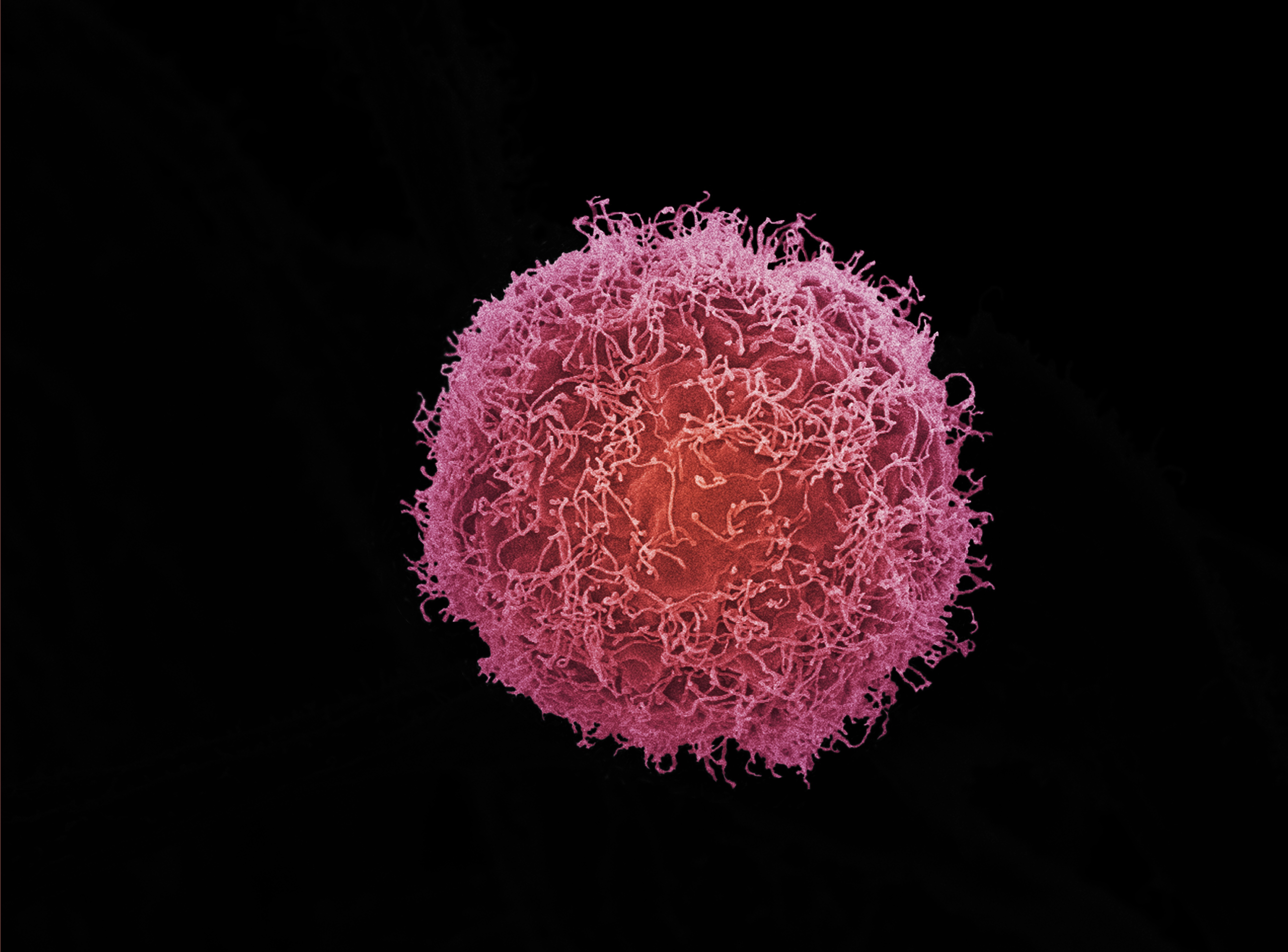 Melanoma Cell Wellcome Collection