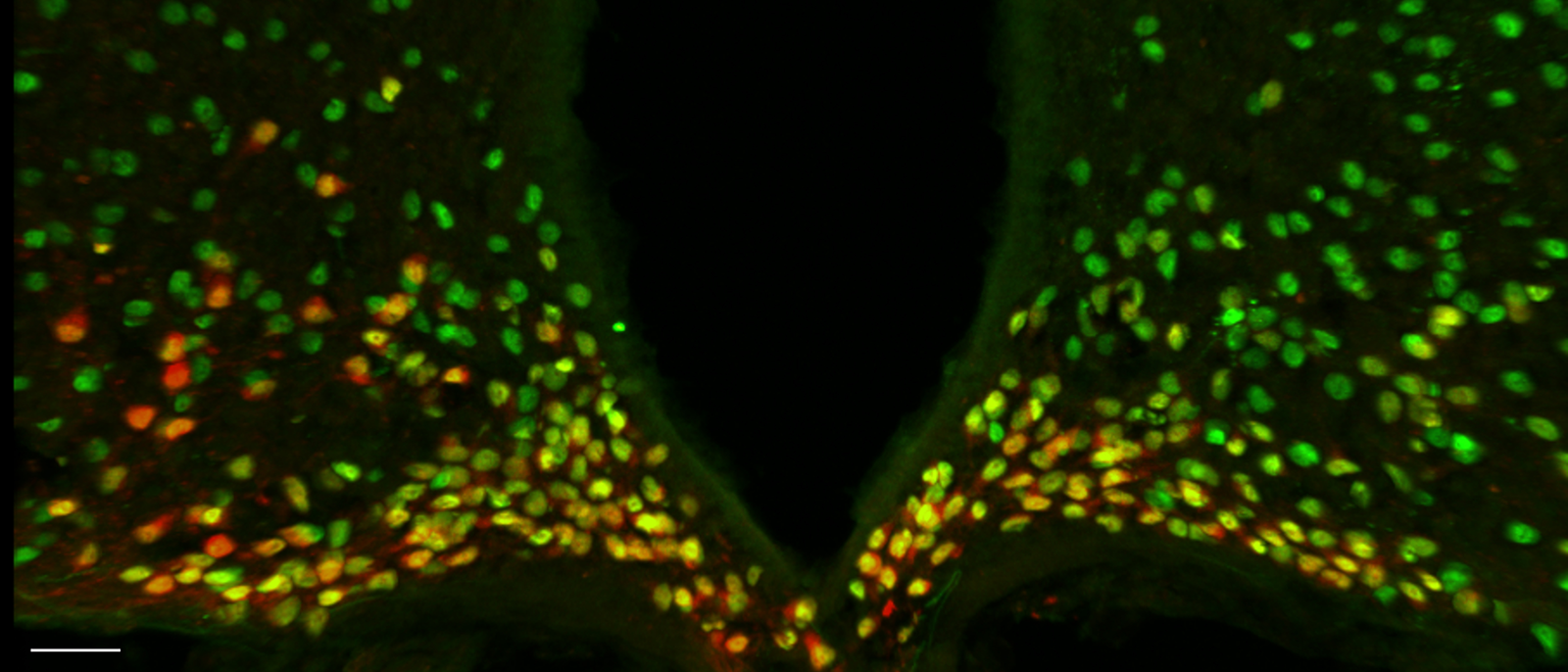 From Brain Wiring To Stress And Metabolism 2