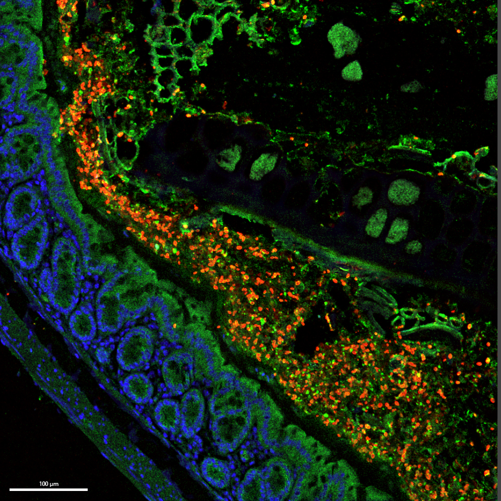 Fungus Vs. Fungus Newly Identified Yeast Might Prevent Life Threatening Fungal Infections 3