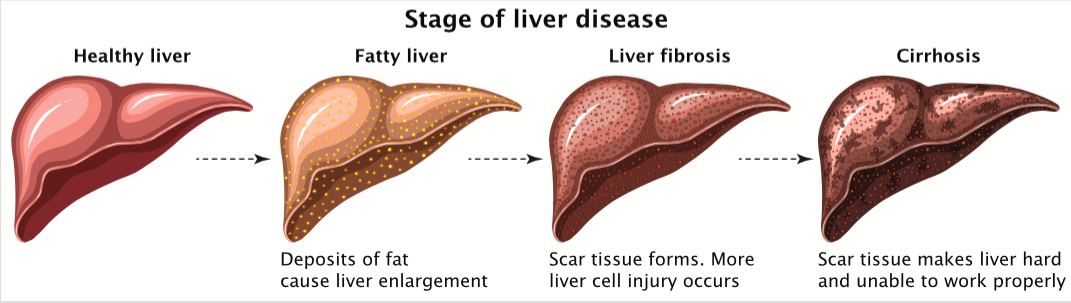 Liver Stage