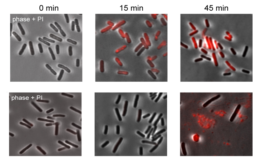 E Coli Bacteria