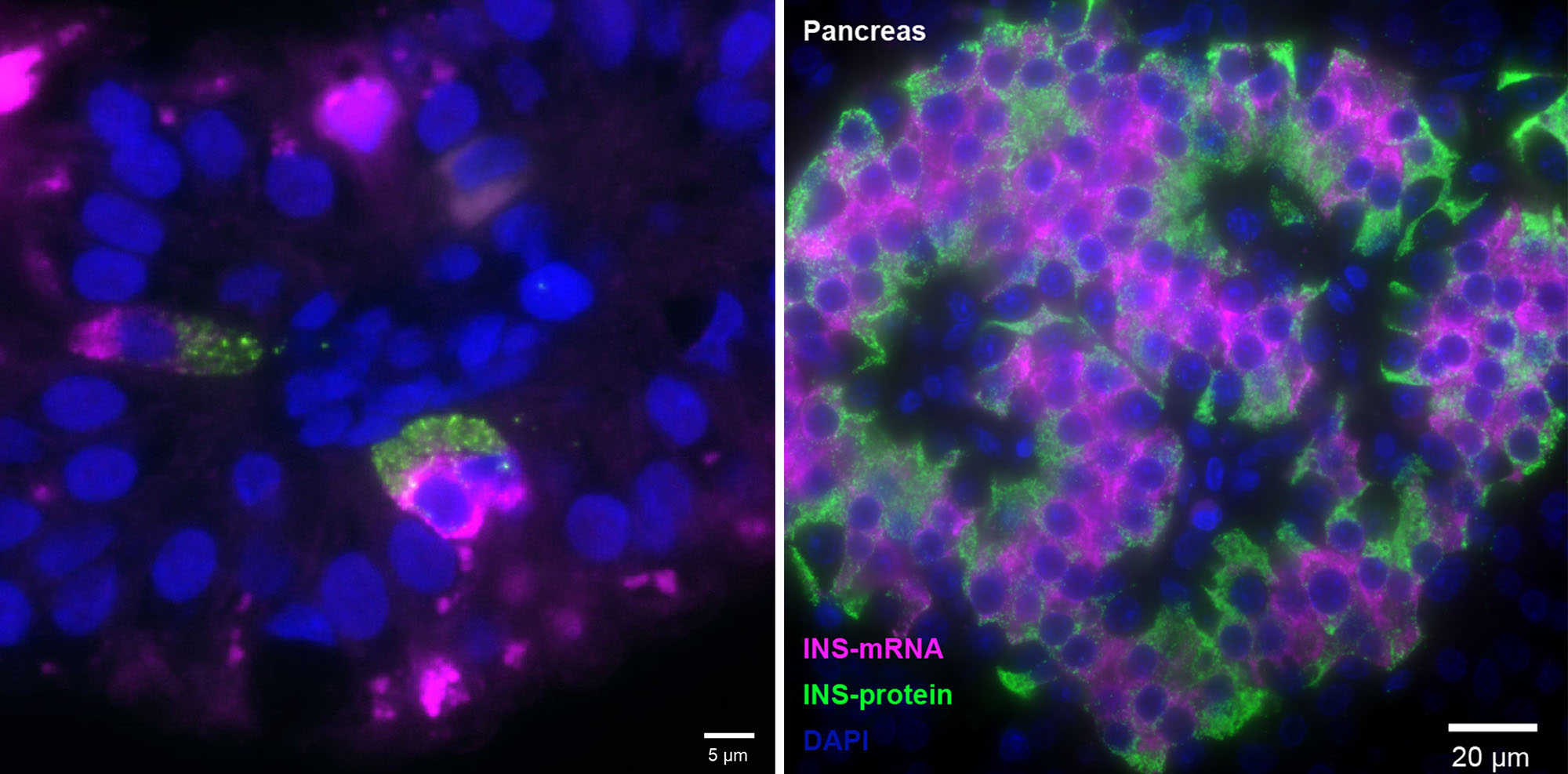 Insulin-Making Cells Discovered in the Fetal Gut