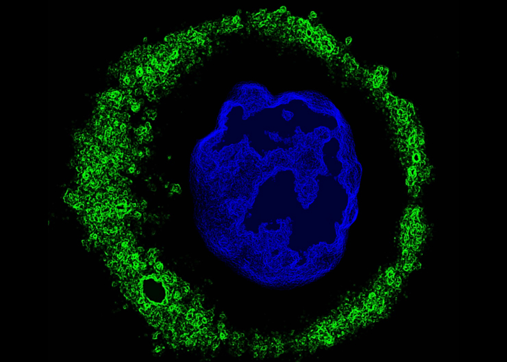 Antibodies Fight Cancer Too