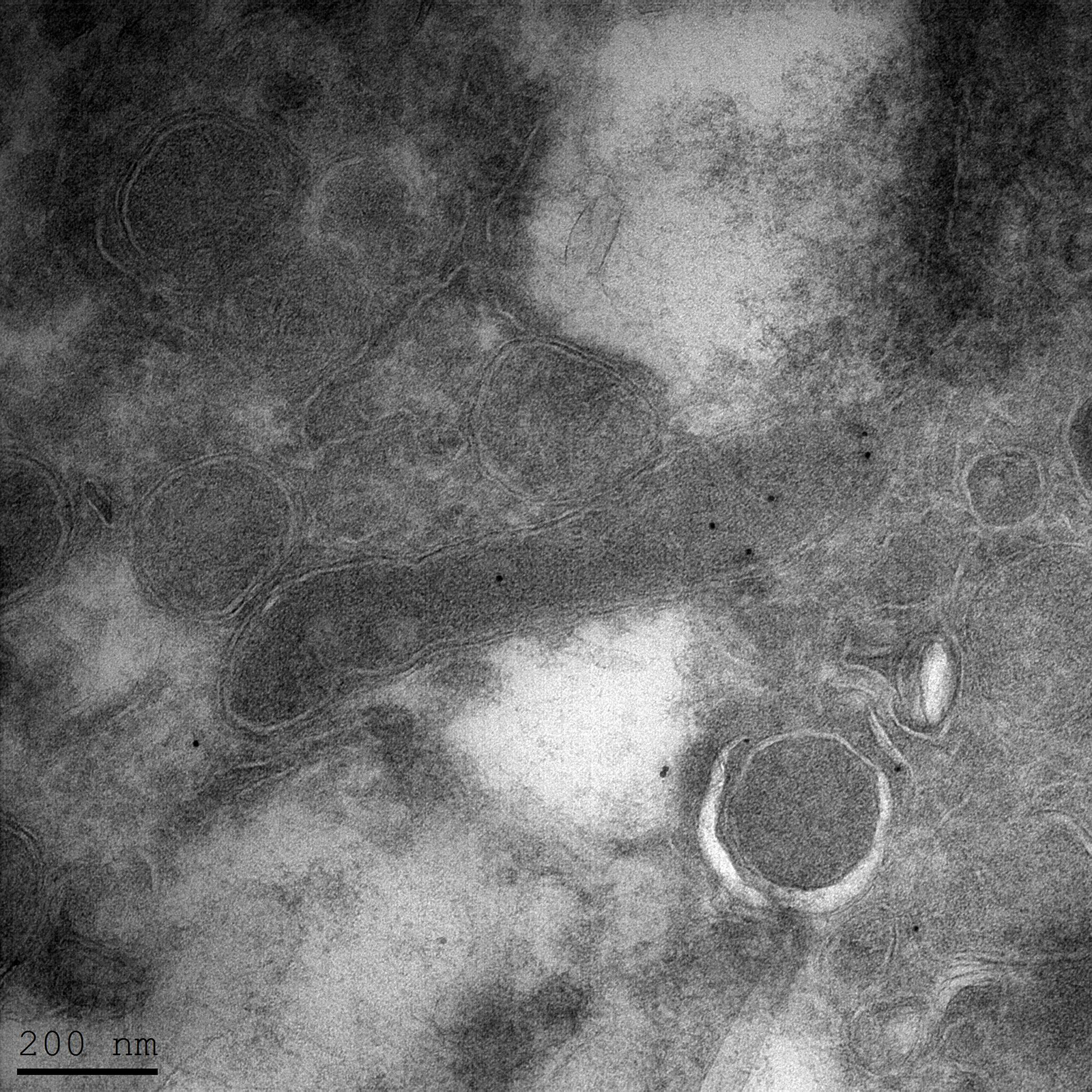 Bacteria On The Brain 3